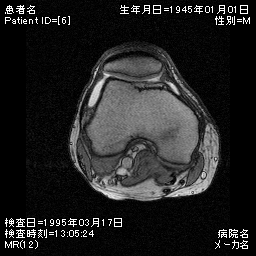 オーバーレイ作成